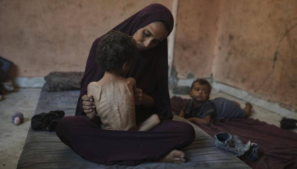 Solche Bilder von hungerleidenden Kindern in Gaza sorgen in Frankreich für Empörung. Bild: Jehad Alshrafi / AP