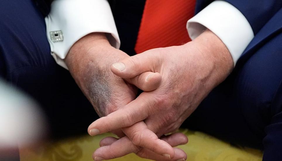 Eine Woche lang hatte der US-Präsident keine öffentlichen Auftritte mehr. Das sorgt in den USA für Spekulationen. Bild: Aaron Schwartz/Pool