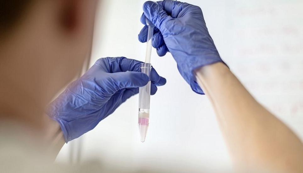 Vorbereitungen im Labor, um gut bewegliche Spermien zu isolieren. Bild: Key
