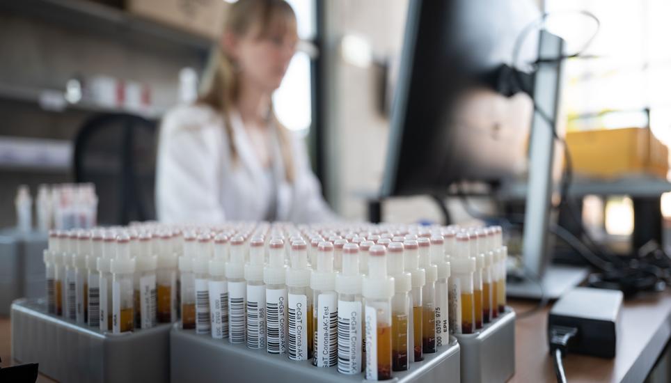 Y-förmige Antikörper reagieren auf eine Infektion mit dem Coronavirus: Wenn Antikörper an Proteine des Virus binden, markieren sie sie damit für die Fresszellen des Immunsystems, bevor das Virus menschliche Zellen befallen kann. Symbolbild: KEYSTONE